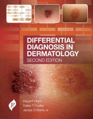 bokomslag Differential Diagnosis in Dermatology