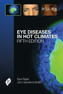Eye Diseases in Hot Climates 1