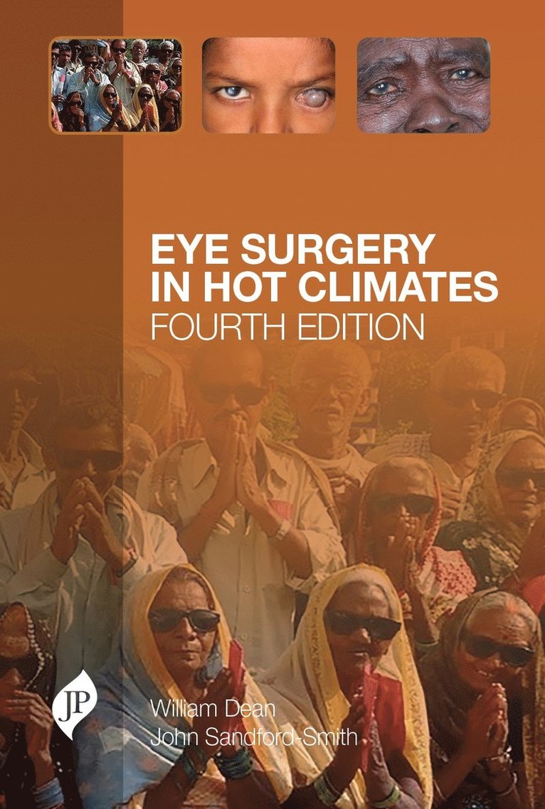 Eye Surgery in Hot Climates