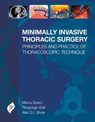 bokomslag Minimally Invasive Thoracic Surgery