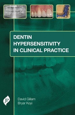 Dentin Hypersensitivity in Clinical Practice 1