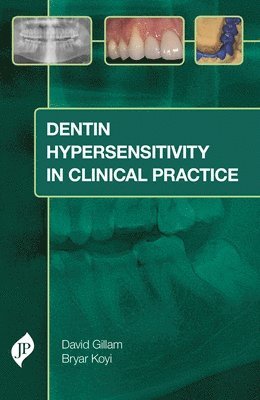 David Gillam, Bryar Koyi - Dentin Hypersensitivity in Clinical Practice, Inbunden
