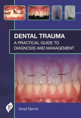 bokomslag Dental Trauma