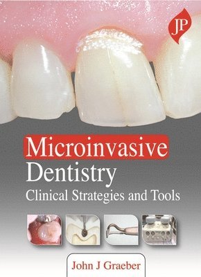 bokomslag Microinvasive Dentistry