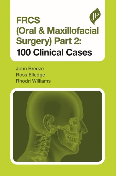 John Breeze, Ross Elledge, Rhodri Williams - FRCS (Oral & Maxillofacial Surgery) Part 2: 100 Clinical Cases, Häftad