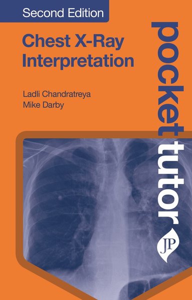 Ladli Chandratreya, Mike Darby - Pocket Tutor Chest X-Ray Interpretation, Häftad