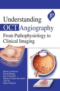 bokomslag Understanding OCT Angiography