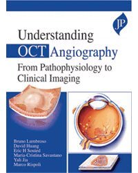 Bruno Lumbroso, David Huang, Eric H Souied, Cristina Maria Savastano, Yali Jia, Marco Rispoli - Understanding OCT Angiography, Inbunden