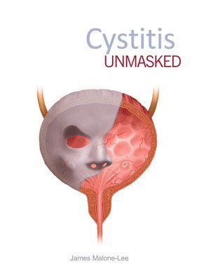 James Malone-Lee, James Malone-Lee - Cystitis Unmasked, Häftad
