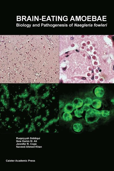 bokomslag Brain-Eating Amoebae