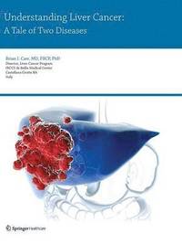 bokomslag Understanding Liver Cancer