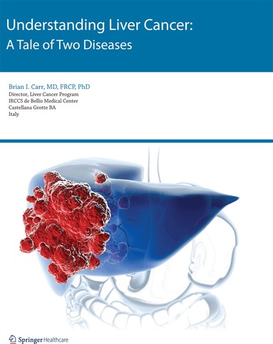 Brian I. Carr - Understanding Liver Cancer, Häftad