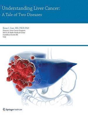 Brian I. Carr - Understanding Liver Cancer, Häftad. Tillgänglighet: Lägg i varukorg
