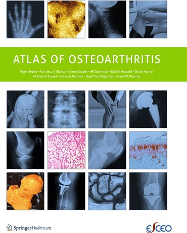 Nigel Arden, Francisco Blanco, C. Cooper, Ali Guermazi, Daichi Hayashi, David Hunter, M. Kassim Javaid, Francois Rannou, Frank Roemer, Jean-Yves Reginster - Atlas of Osteoarthritis, Häftad