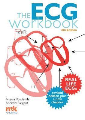 The ECG Workbook 1