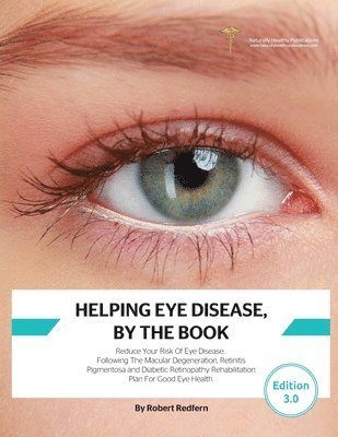 Robert Redfern - Helping Eye Disease, By The Book, Häftad