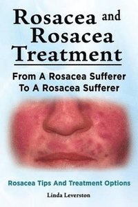 bokomslag Rosacea and Rosacea Treatment. From A Rosacea Sufferer To A Rosacea Sufferer. Rosacea Tips And Treatment Options