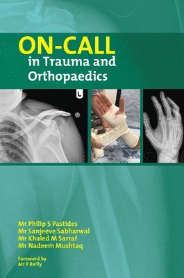 On Call in Trauma and Orthopaedics 1
