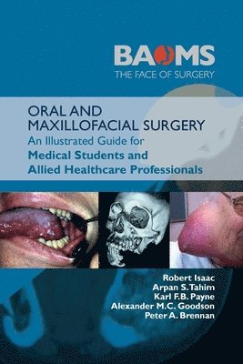 bokomslag ORAL AND MAXILLOFACIAL SURGERY