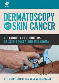 bokomslag Dermatoscopy and Skin Cancer