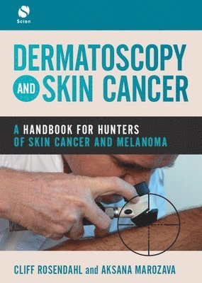 Cliff Rosendahl, Aksana Marozava - Dermatoscopy and Skin Cancer, Häftad