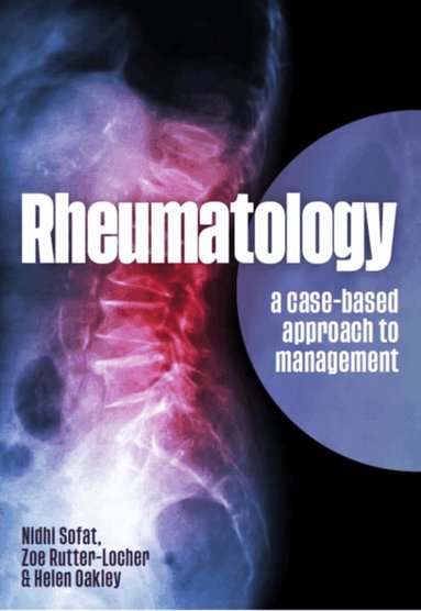Nidhi Sofat, Zoe Rutter-Locher, Helen Oakley - Rheumatology, Häftad