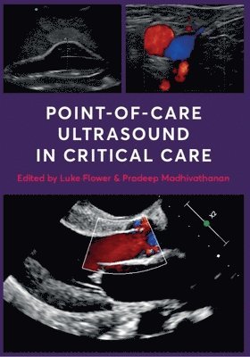 Point-of-Care Ultrasound in Critical Care 1