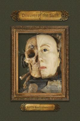 Simon Kurt Unsworth - Diseases of the Teeth, Häftad