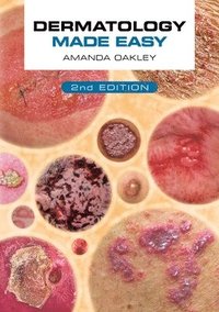 bokomslag Dermatology Made Easy, second edition