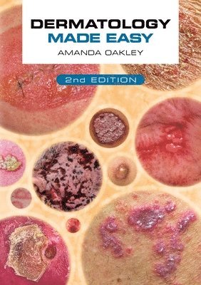 bokomslag Dermatology Made Easy, second edition