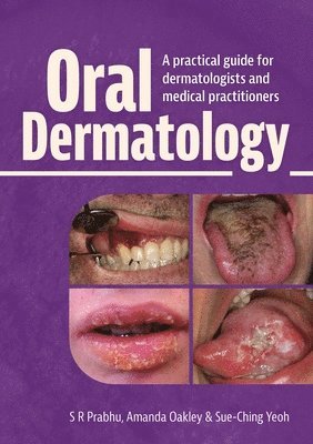 bokomslag Oral Dermatology