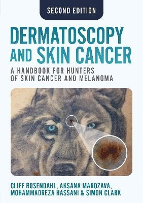 bokomslag Dermatoscopy and Skin Cancer, second edition