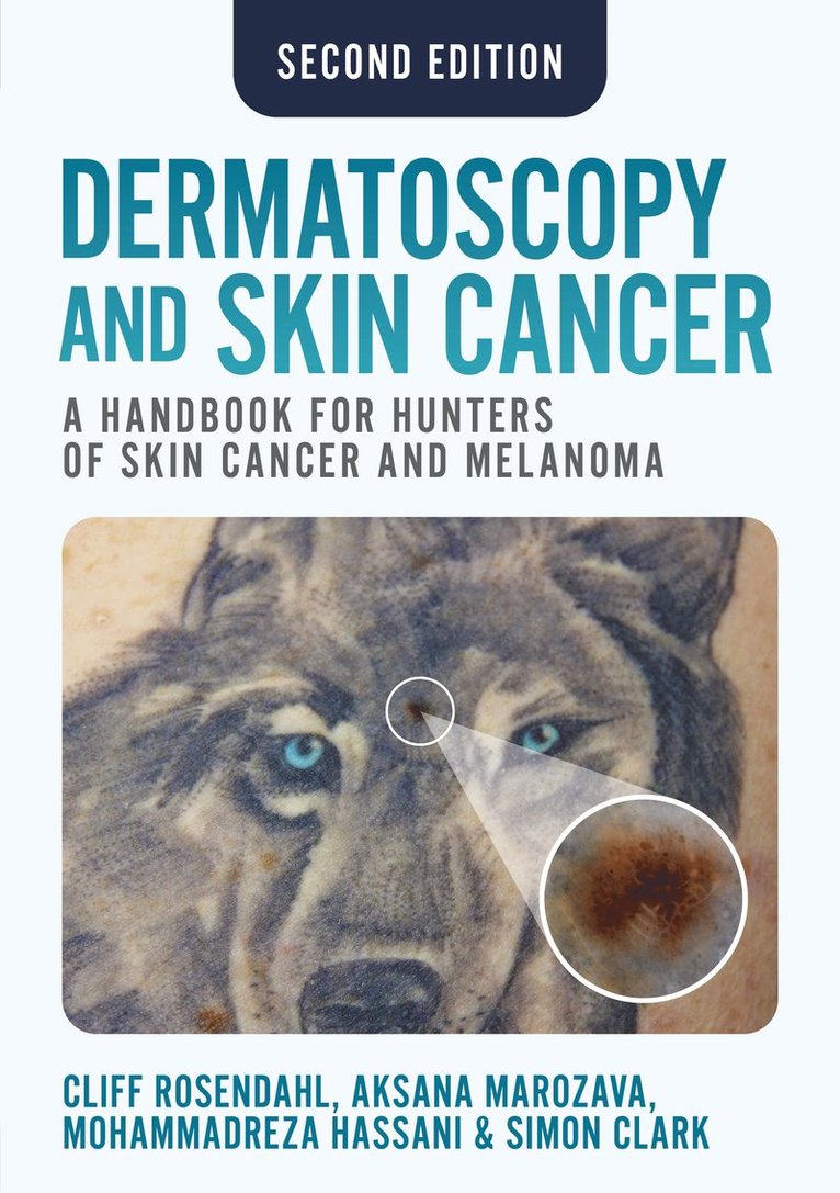 Cliff Rosendahl, Aksana Marozava, Mohammadreza Hassani, Simon Clark - Dermatoscopy and Skin Cancer, second edition, Häftad