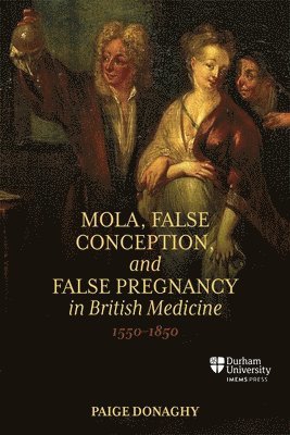 Mola, False Conception, and False Pregnancy in British Medicine, 1550–1850