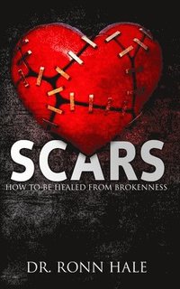 bokomslag Scars: How to Be Healed from Brokenness