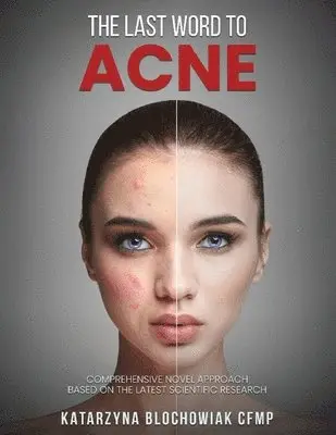 Katarzyna Blochowiak - Last Word To Acne, Häftad. Tillgänglighet: Lägg i varukorg