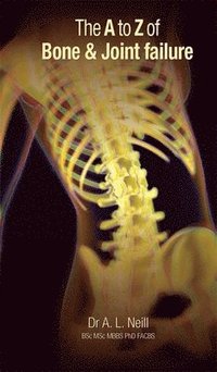 bokomslag A to Z of Bone and Joint Failure