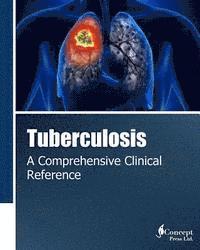 bokomslag Tuberculosis: A Comprehensive Clinical Reference