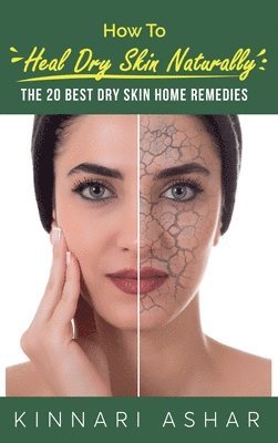 Kinnari Ashar - How to Heal Dry Skin Naturally, Inbunden