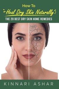 bokomslag How to Heal Dry Skin Naturally