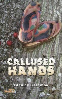 Callused Hands 1