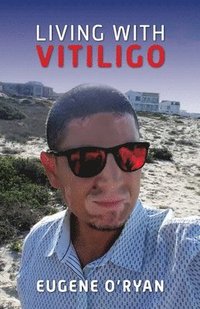 bokomslag Living with Vitiligo