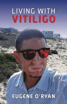 bokomslag Living with Vitiligo