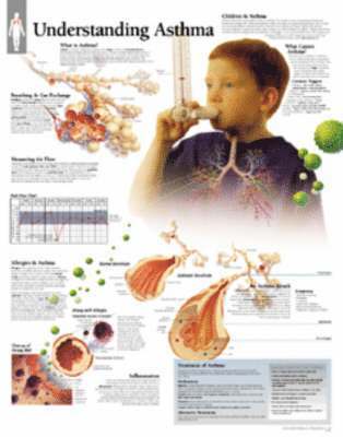 bokomslag Understanding Asthma