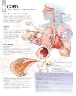 Copd, Paper Chart 1