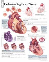 bokomslag Understanding Heart Disease, Laminated Chart