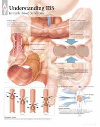 bokomslag Understanding IBS