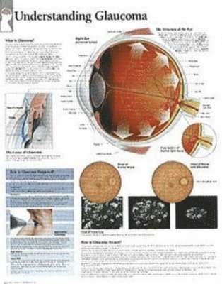 Understanding Glaucoma Chart 1