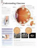 bokomslag Understanding Glaucoma Chart