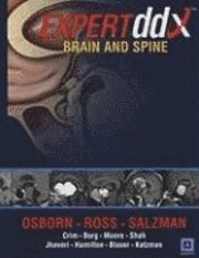 bokomslag EXPERTddx : Brain and Spine